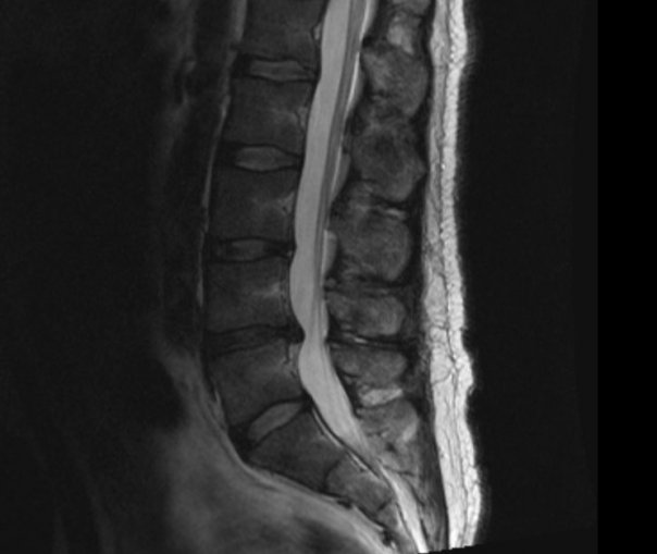 My dodgy back.